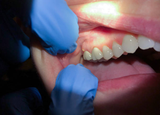 Best Weekend Emergency Dentist in Fairfield University, CT