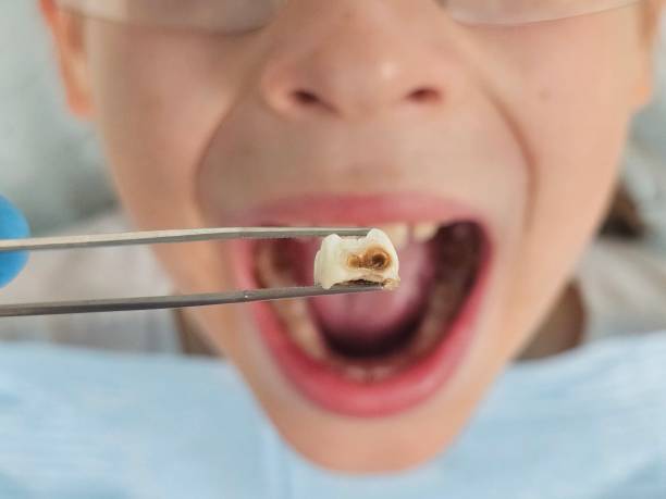 Best Emergency Dental Services for Seniors in Fairfield University, CT